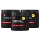 iRestoreは女性のための高度の毛の成長の補足、より速い毛の再生のための毛のビタミン、毛損失および薄くなることのためのベストを- 1つの月の供給それぞれ- 30の計算(3)のパック-黒貯えます