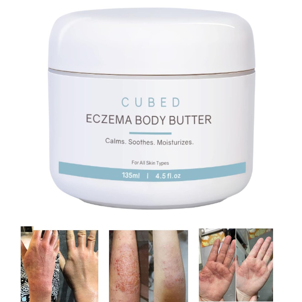 大人のための立方4.5のozのEczemaのクリーム、Eczemaの救助、Eczemaの処置、Moisturize乾燥した隔離された皮、Topicalステロイドの出血の症状、乾癬及びRoscea、Eczema、皮膚炎