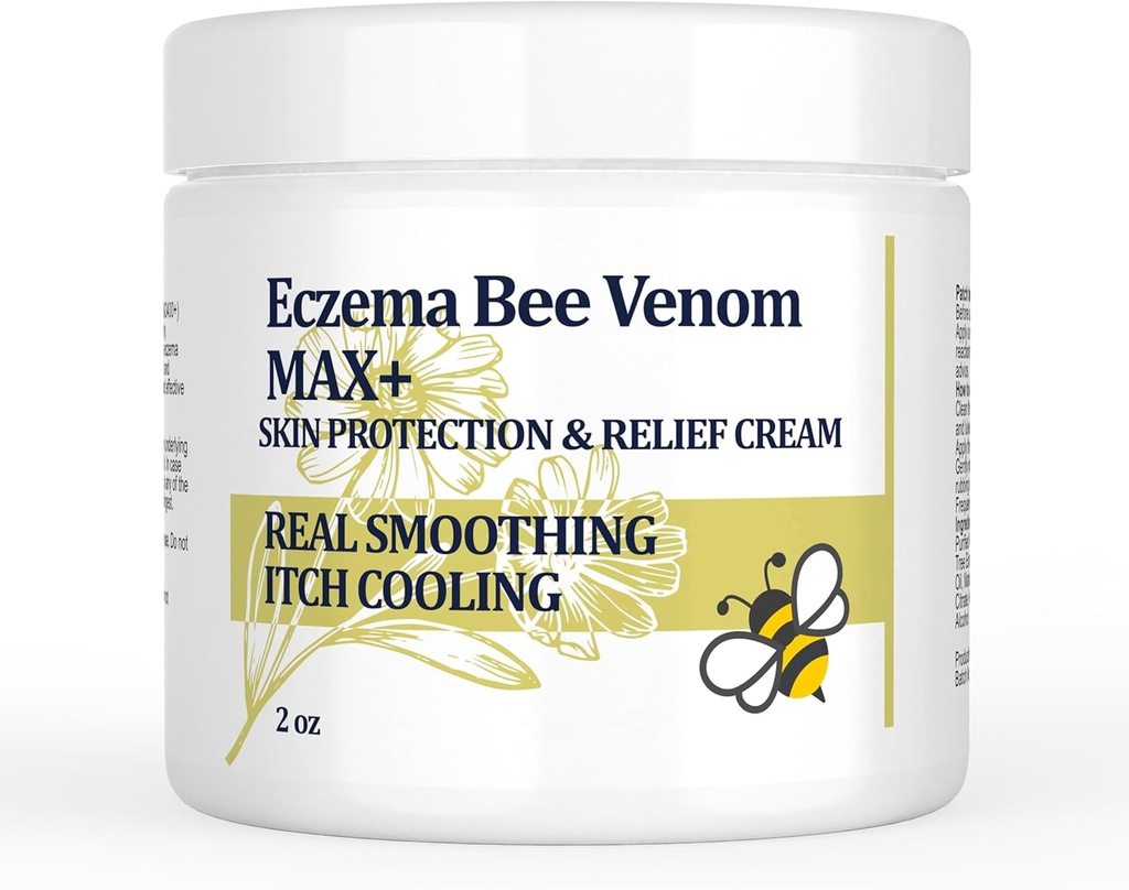 高力蜂のVenomのクリーム、Dyshidrotic Eczemaの軟膏、熱Rash、かゆみ、Eczema、Psoriasis、足、胃、フィート、手、Irritated皮、すべての年齢の心配