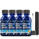 4Pcs足の爪の菌の処置、25%のUndecylenicの酸、爪のための釘の菌類の処置(2つのFLのOZ)