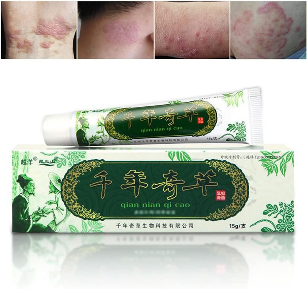 海外の千年草のクリームの中国の草のEczema、乾癬のクリームの皮膚炎およびEczemaのPruritusの乾癬JIULINの軟膏