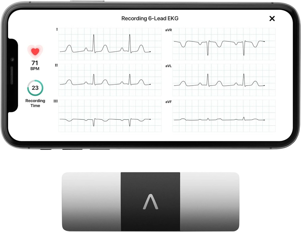 AliveCor KardiaMobile 6 リードパーソナル EKG モニター – ハートの 6 つのビュー – AFib と不規則な Arrhythmias を検出します。 – インスタント結果 30 秒 – ほとんどのスマートフォンで動作します。