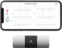 AliveCor KardiaMobile 6 リードパーソナル EKG モニター – ハートの 6 つのビュー – AFib と不規則な Arrhythmias を検出します。 – インスタント結果 30 秒 – ほとんどのスマートフォンで動作します。