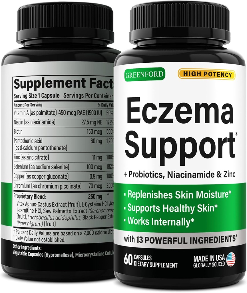 天然の救済のためのグリーンフォード湿疹の治療とサポート - 米国製 - 皮膚ビタミン&Eczema、アクネ、乾癬、亜鉛、ナイアシンアミド&プロバイオティクスによるロサセア治療 - 60キャップ