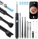 Loyker X6の耳のワックスの取り外し用具のカメラ、カメラが付いている耳の洗剤、FSA - HSAの店の適性、耳/鼻/Throat/Tonsilの石の検査のための6LEDライトが付いている1080P耳のカメラ