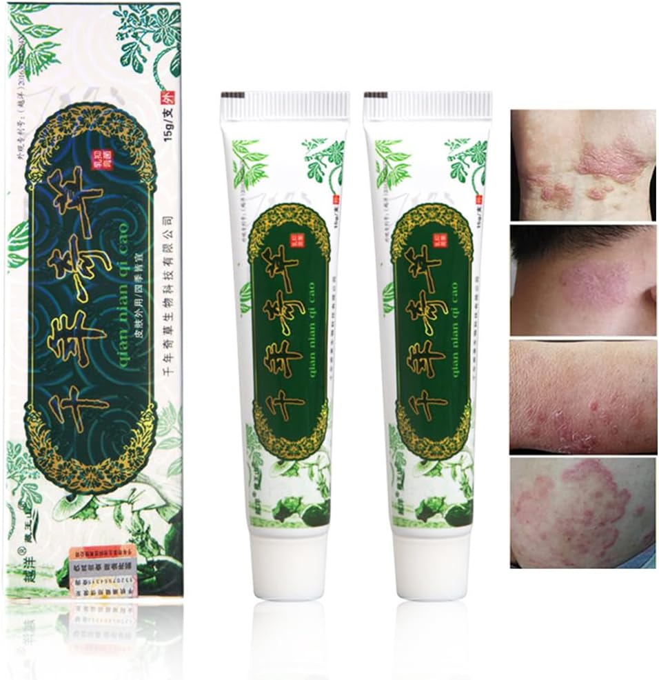 海外の千年草のクリームの中国の草のEczema、乾癬のクリームの皮膚炎およびEczemaのPruritusの乾癬JIULINの軟膏(2PCS)