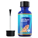 Toenail Fungus Treatment Extra Strength - Nail Fungus Treatment for Toenail - Toe Nail Fungus Treatment Extra Strength - Nail Fungus Treatment (30ml)